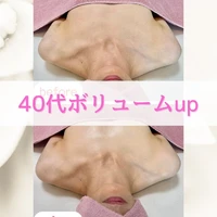 画像236