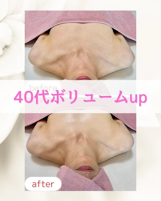 画像236