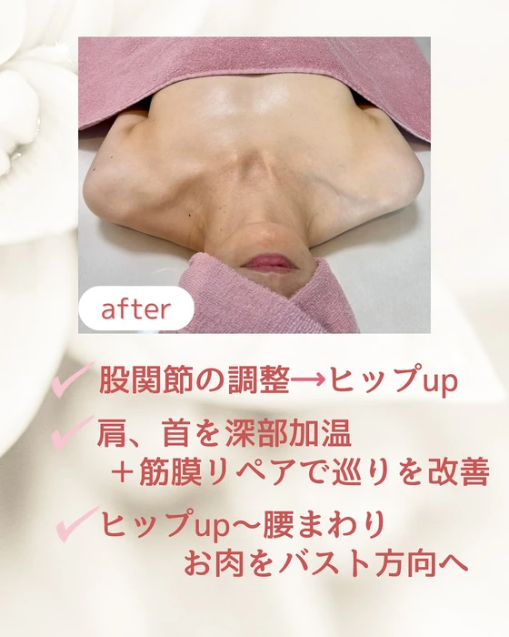 画像238