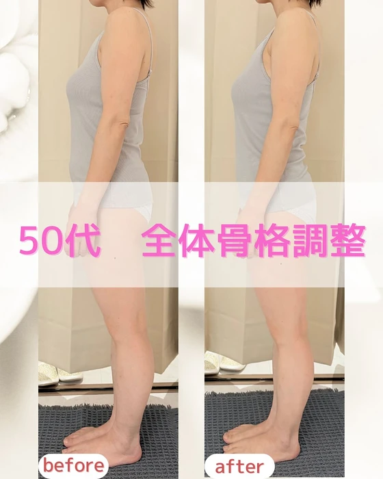 画像252